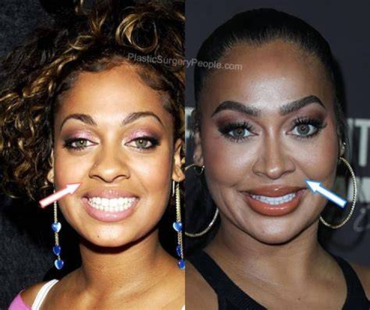 La La Anthony Plastic Surgery and Body Measurements Plastic Surgery Feed